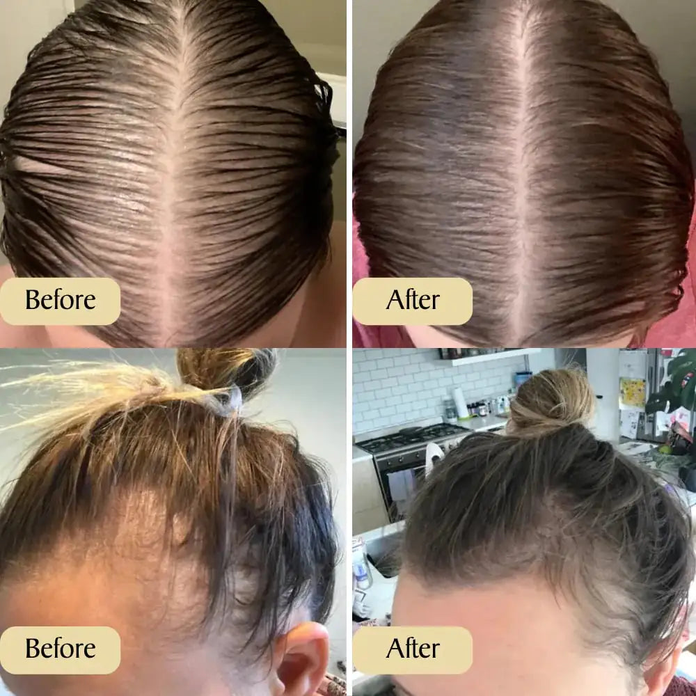 Regrowth Cali - Hair Growth Oil