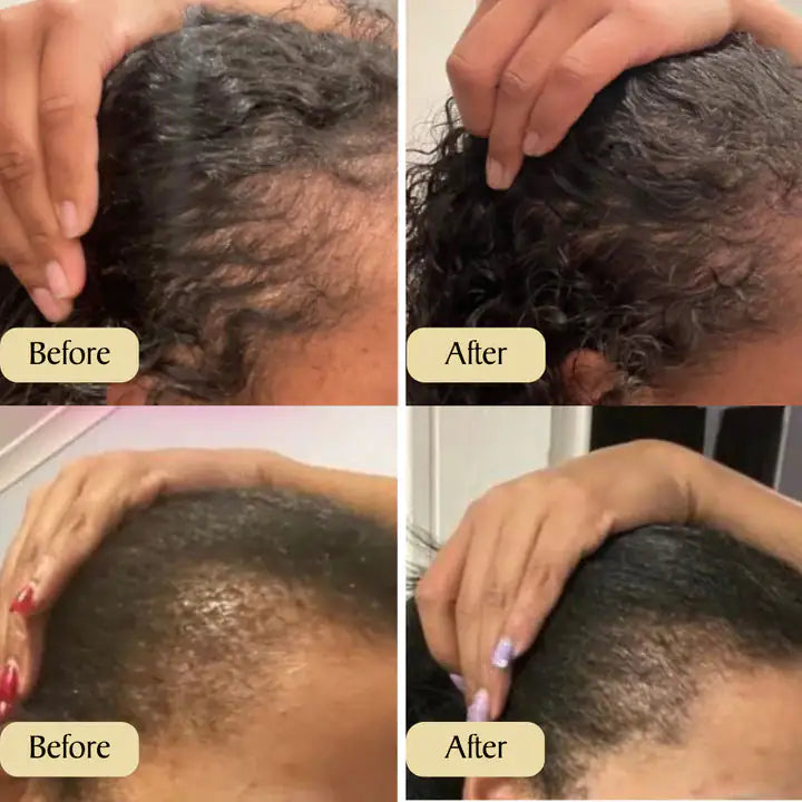 Regrowth Cali - Hair Growth Oil